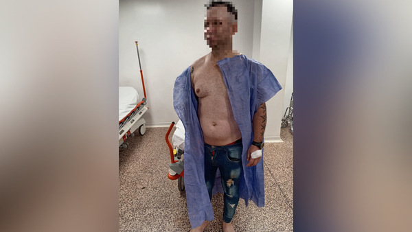 Hieren con arma blanca a un hombre en el barrio Nueva Esperanza de Encarnación