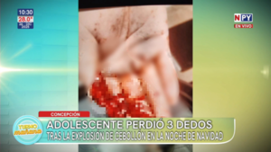 Adolescente pierde parte de sus dedos tras explosión de un "cebollón"