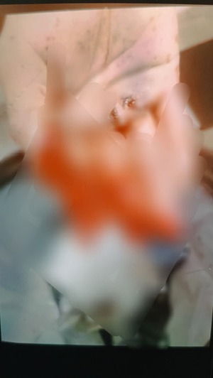 Popular / Tragedia:Péndex opyta sin dos dedos al explotarle un cebollón.