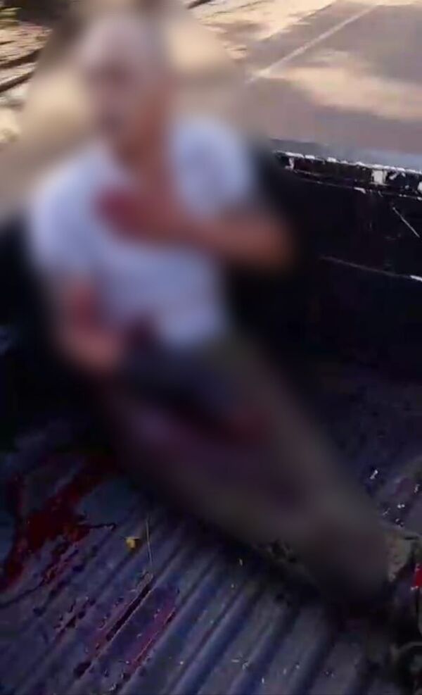 Hombre resulta herido tras romper una botella de vidrio - Concepción al Día