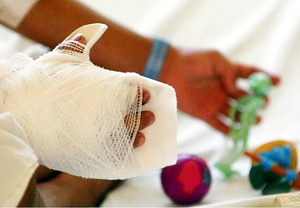 Niñas sufren quemaduras por pirotecnia: padres fueron imputados - trece