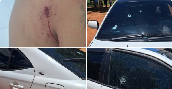 Sicario dispara ocho veces contra suboficial en Yby Yaú