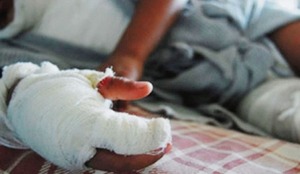 Imputan a padres de hermanitas que sufrieron quemaduras por petardos en Capitán Bado