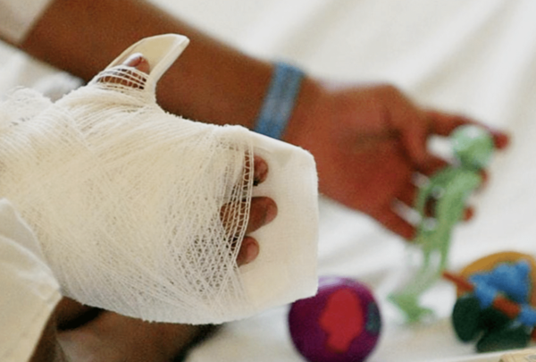 Imputan a padres de niñas quemadas por petardos en Bado