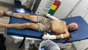 Mujer fue aprehendida tras atacar con machete a un hombre en Limpio