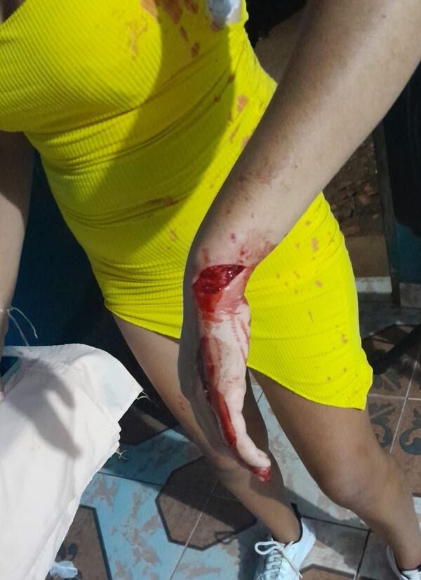 Violenta gresca entre vecinos y parientes dejó dos mujeres heridas en Concepción - Concepción al Día