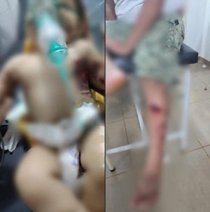 Explosión de pirotecnia deja tres niños heridos; una bebé permanece en UTI