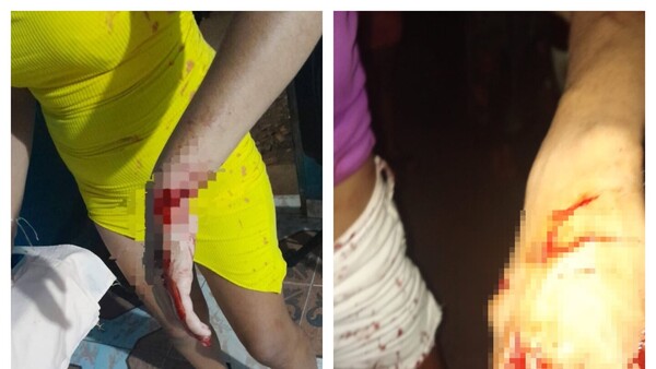 Tres heridos en riña en pleno Año Nuevo