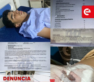 Denuncian presunta mala praxis tras cirugía de apendicitis en el Hospital Regional de Caacupé: joven debió ser reoperado por infección severa - Canal-E
