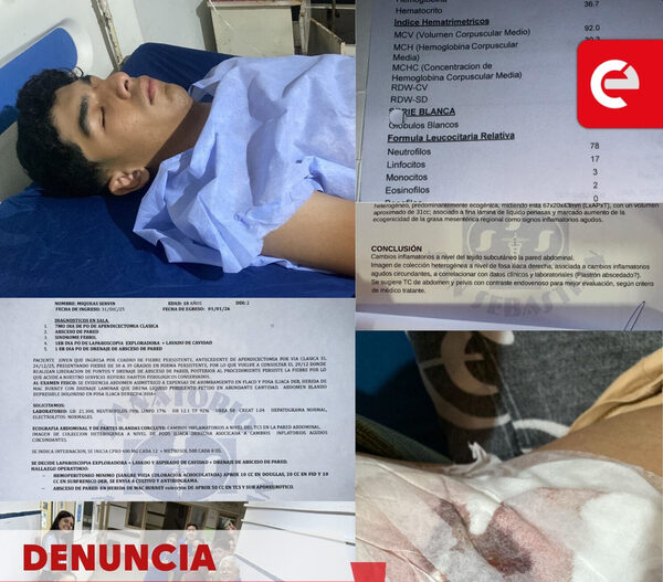 Denuncian presunta mala praxis tras cirugía de apendicitis en el Hospital Regional de Caacupé: joven debió ser reoperado por infección severa - Canal-E