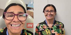 PRÓTESIS DENTALES GRATUITAS MEJORAN LA CALIDAD DE VIDA DE PACIENTES