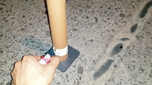 Una explosión de 12 x 1 hirió a tres niños: uno está grave