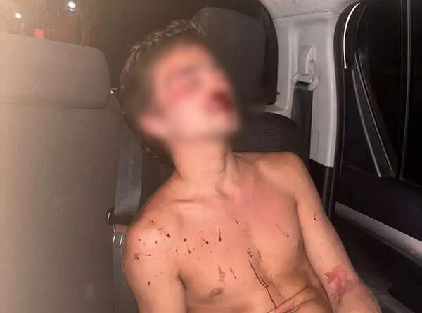 Rebeldía y orden de captura para acusado por lesión grave - Nacionales - ABC Color