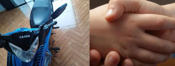 Niña fallece tras caer de una motocicleta conducida por su hermana de 11 años - Concepción al Día