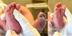 TEST DEL PIECITO FORTALECE LA ATENCIÓN NEONATAL EN ITAPÚA