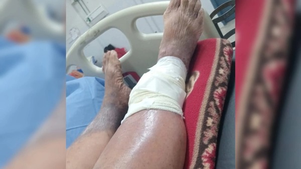 Popular / Doñita ingresó agusanada en IPS y solo le aplicaron vaselina