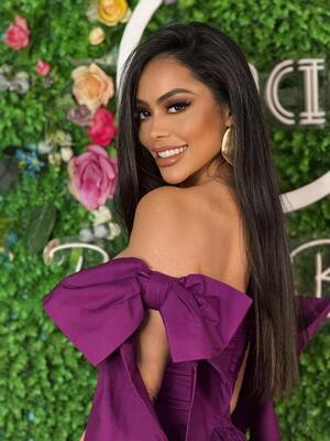 Popular / Caso Canela: Jennifer Ruiz Diaz pidió que se promulgue una ley contra la pirotecnia