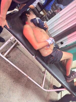 Popular / Hombre fue atacado a balazos, quedó vivo para delatar a autores