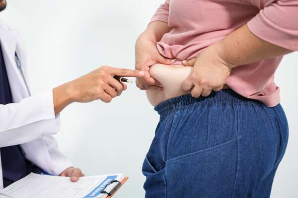 Interrupción de medicamentos para bajar de peso favorece el efecto rebote en dos años - Ciencia - ABC Color