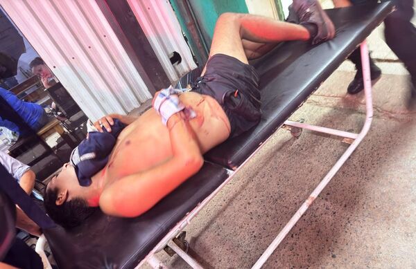 ¿Fallido sicariato en Luque?: Exconvicto recibió 5 balazos y quedó grave •