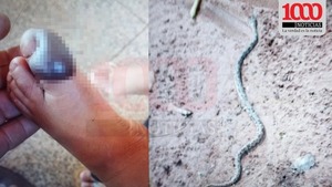 Niño de 2 años fue mordido por una serpiente yarará en Bella Vista Norte