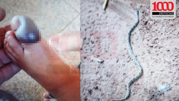 Niño de 2 años fue mordido por una serpiente yarará en Bella Vista Norte