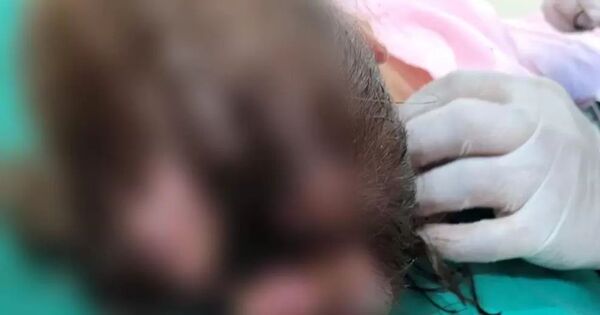 ¡Criminal! Niña fue infestada con gusanos y piojos - ADN Digital