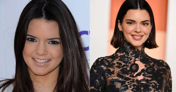 La Nación / Kendall Jenner desmiente cirugías: “Lo único he hecho es baby botox”