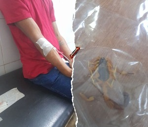 Popular / Karai'y fue picado por un alacrán en su jyva