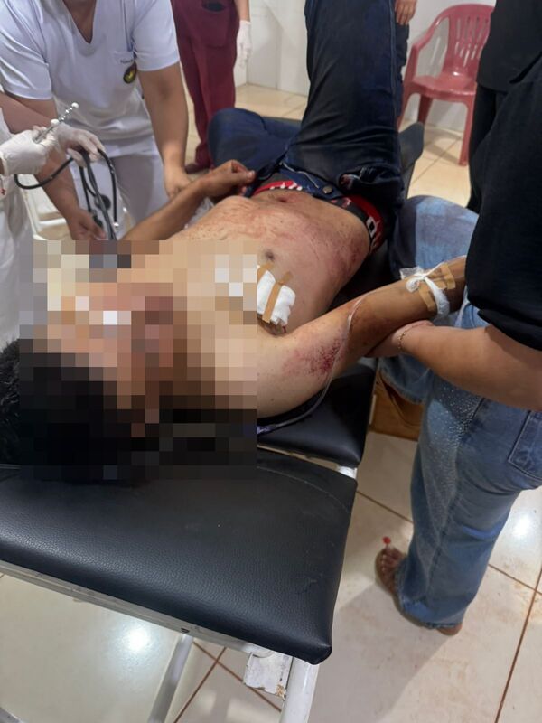 Popular / Dos hombres quedaron heridos durante una riña en Corpus Christi