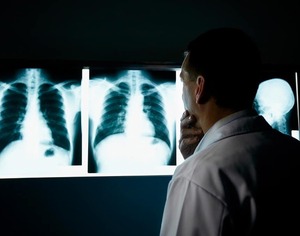 Desde el INERAM reportan hasta cinco nuevos casos de cáncer de pulmón por semana - La Tribuna