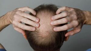 El novio tenía un lindo pelo, pero en la intimidad se le cayó su peluca ha opa el amor