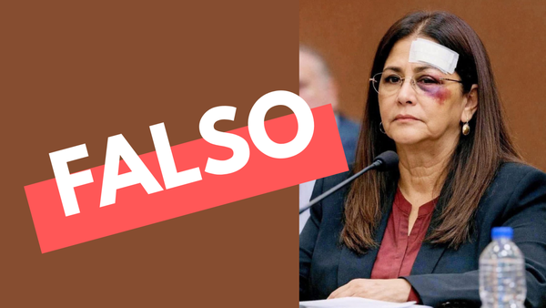 Es falsa una foto que muestra a Cilia Flores con un hematoma alrededor de su ojo izquierdo