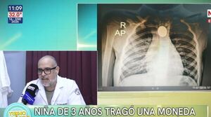 Rápida intervención médica salva a niña de tres años que tragó una moneda