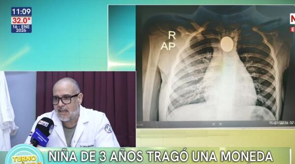 Rápida intervención médica salva a niña de tres años que tragó una moneda