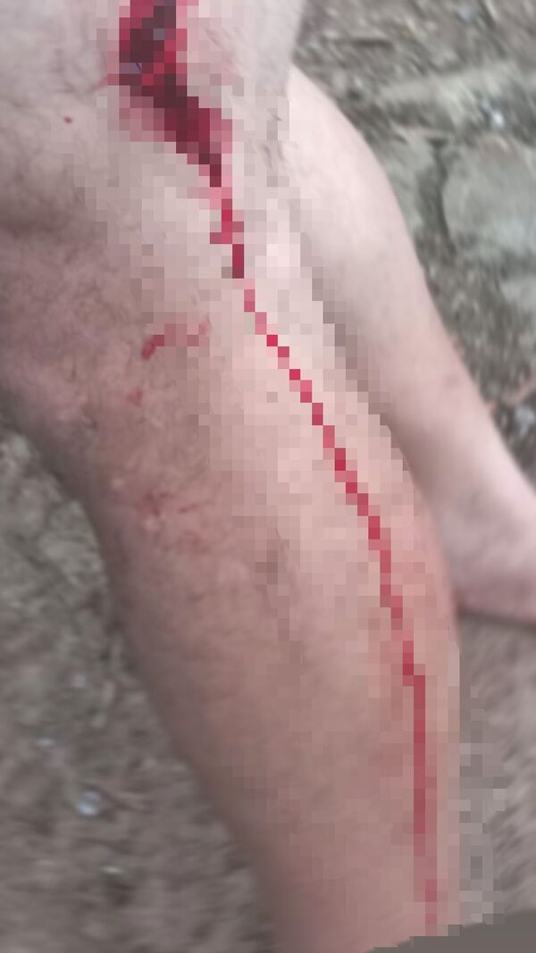 Hombre fue apuñalado por su compañero de tragos en San Pedro del Paraná