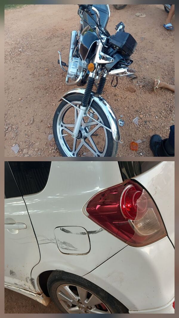 Menor protagoniza accidente de tránsito y sufre fractura de cadera en Concepción - Concepción al Día