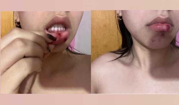 Precandidato a intendente de Ypané es acusado por violencia familiar