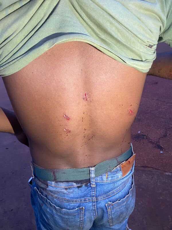 Pelea entre hermanos dejó un herido y dos detenidos en Natalio