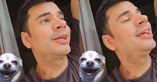 Diario HOY | Sebastián Rodríguez y un chupón: “Cuando toca, toca”