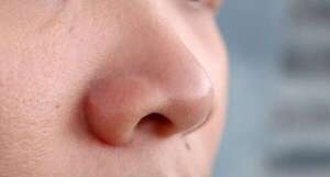 Investigación revela el papel defensivo de las fosas nasales contra el rinovirus - Ciencia - ABC Color