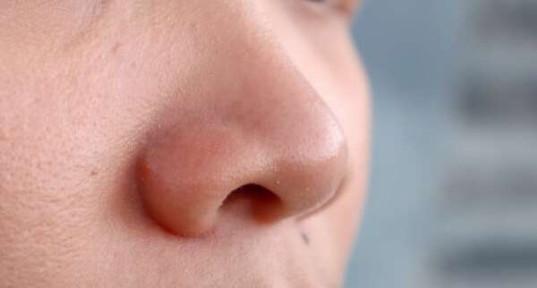 Investigación revela el papel defensivo de las fosas nasales contra el rinovirus - Ciencia - ABC Color