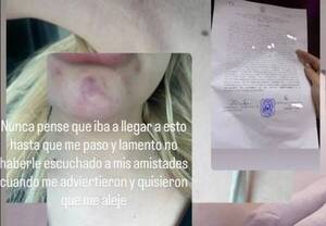 ¡Terrible! Su amiga le salvó de morir ahorcada