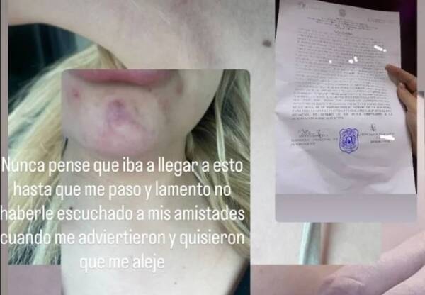 ¡Terrible! Su amiga le salvó de morir ahorcada