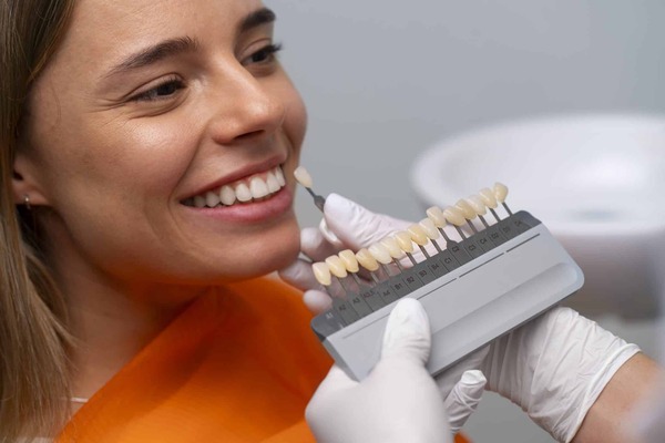 Carillas dentales: La clave para una sonrisa armónica