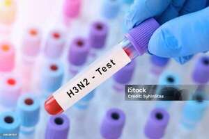 Argentina registra la primera muerte por la variante K de la influenza A H3N2 - Mundo - ABC Color