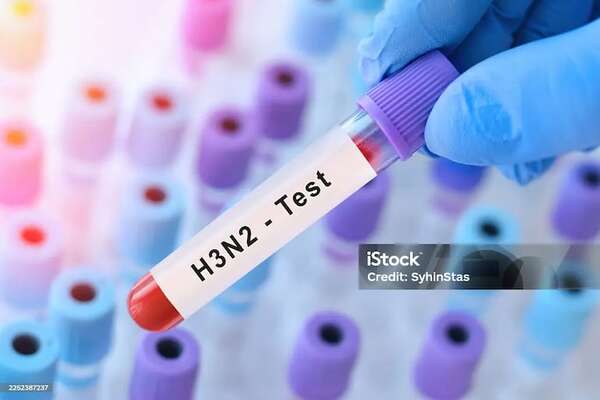 Argentina registra la primera muerte por la variante K de la influenza A H3N2 - Mundo - ABC Color