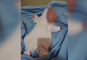 Recién nacida se enfrenta a una dura batalla: necesita ayuda para poder someterse a una cirugía - trece