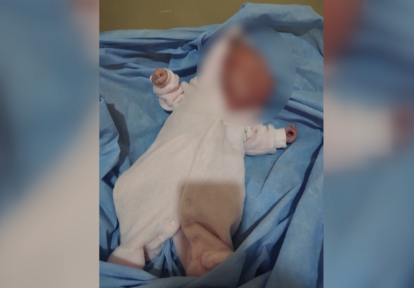 Recién nacida se enfrenta a una dura batalla: necesita ayuda para poder someterse a una cirugía - trece