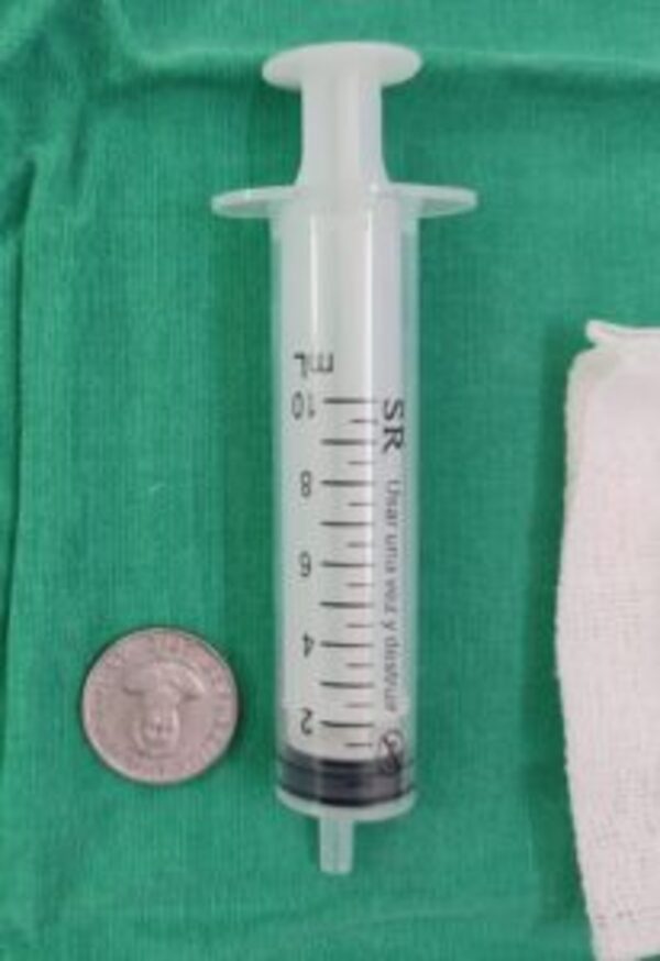 Popular / ¡Cuarto caso en el año! Mitã'i ijahy'opa'ã con moneda de 100'i